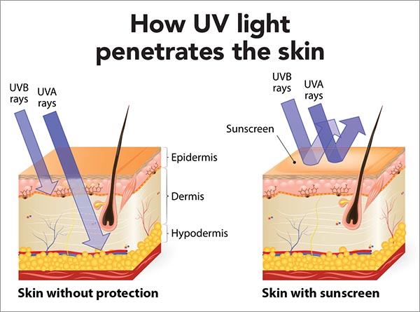 UVB and UVA rays damage skin, though UVA penetrates deeper. Broad spectrum sunscreens filter both.