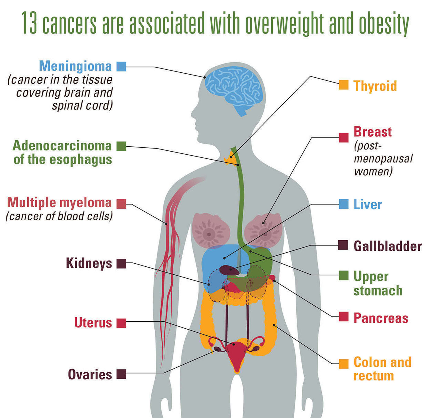 Excess weight: an important cause of cancer.