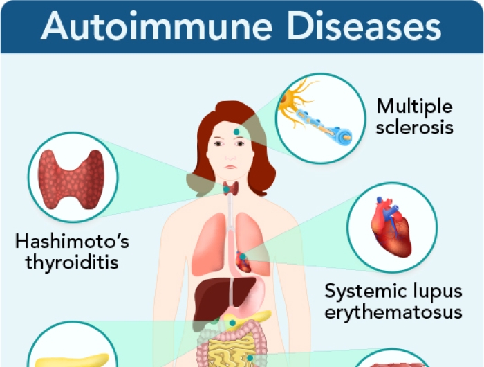 autoimmune diseases diagram