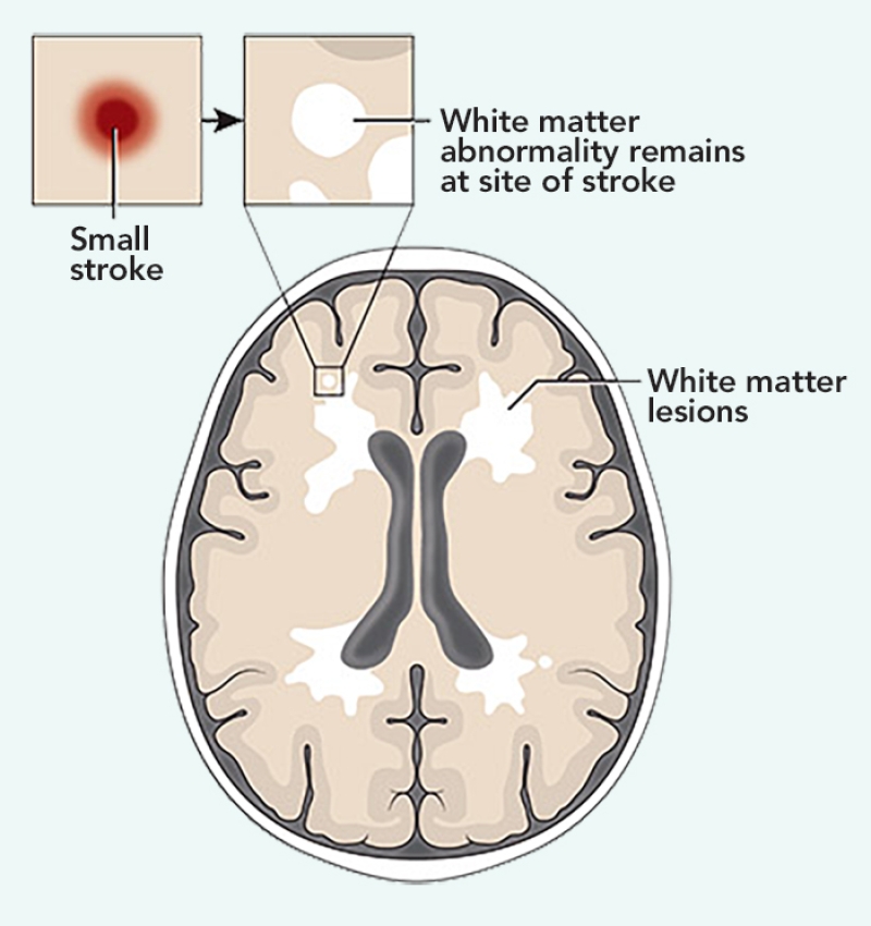 brain diagram